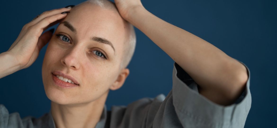 A happy woman with shaved hair touching her head and smiling