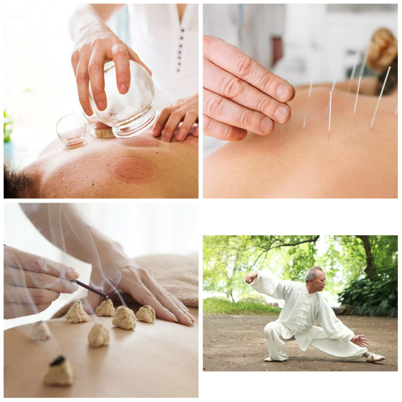 Cupping; top left (The Thirty), Acupuncture; top right (Forbes), Moxibustion; bottom left (American institute of Alternative Medicine), Tai Chi; bottom right (Britannica)